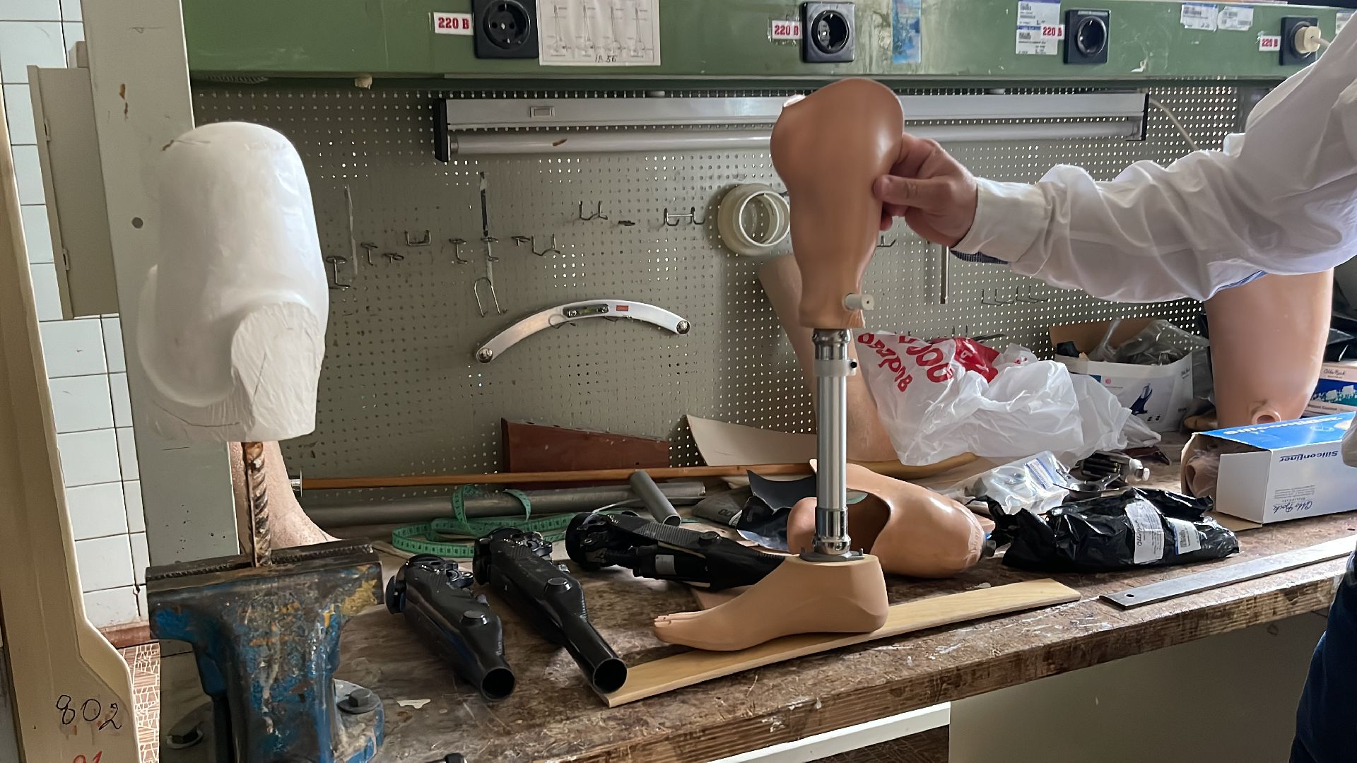 Руза, ЦВТ им. М. А .Лиходея, протез, реабилитация, Донецк, СВО