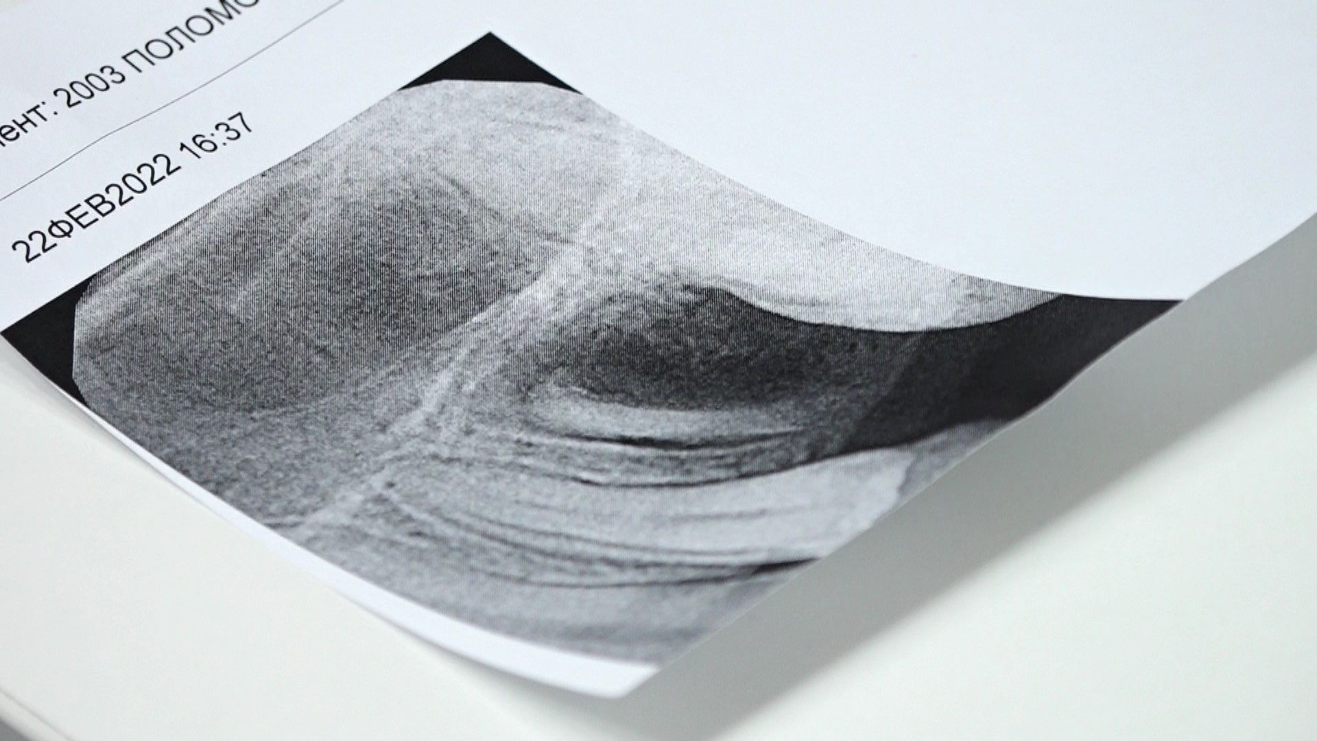 стоматология, протезирование, Домодедово