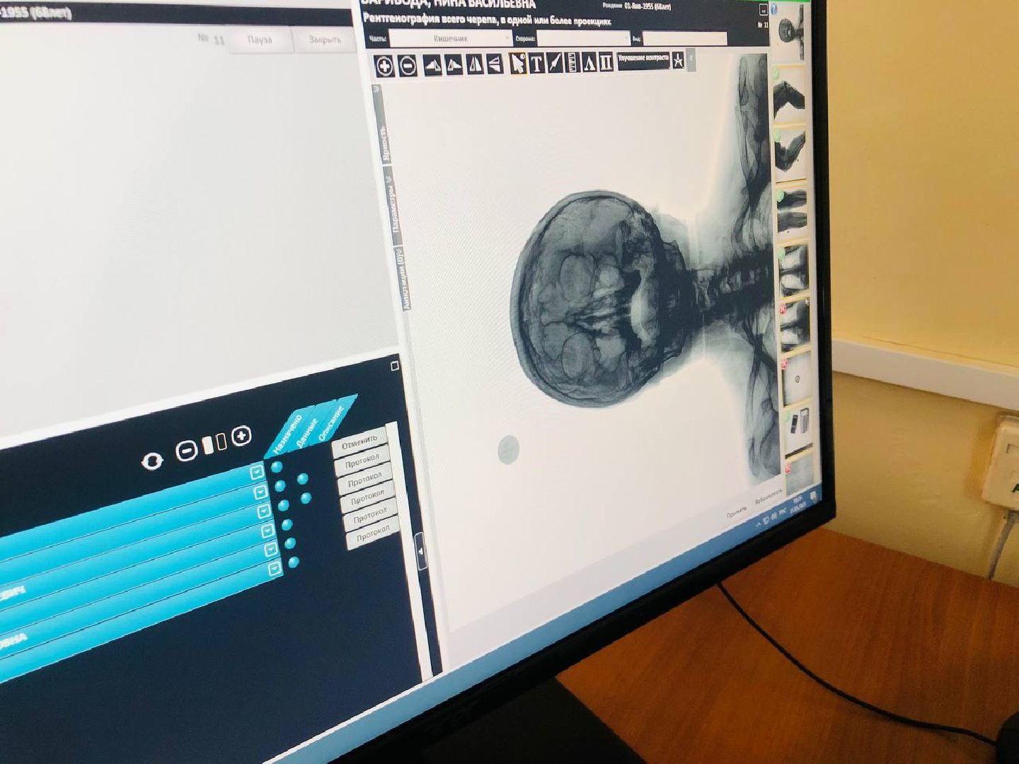 руза, медицина, рентген, рентген-кабинет, здоровье