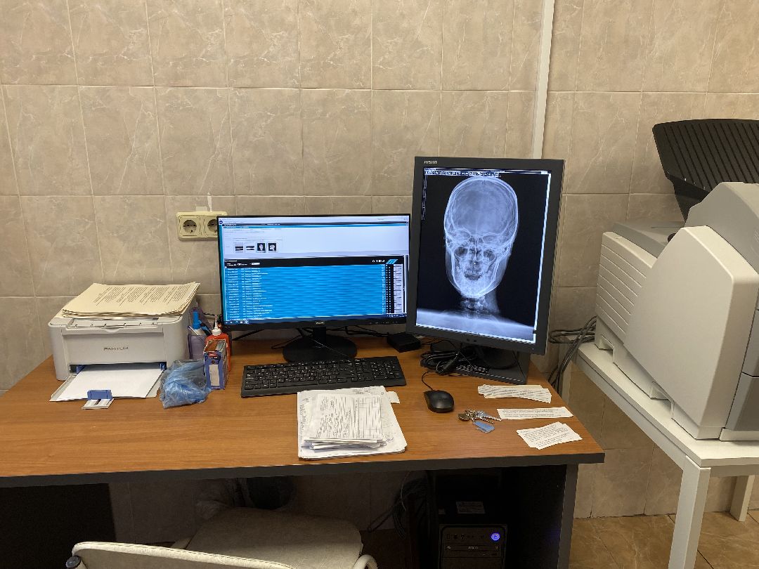 Медицина, аппарат, камни