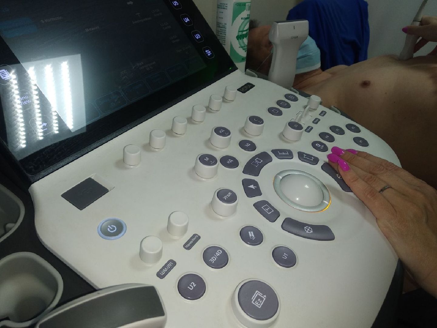 Дмитровская областная больница, Региональный сосудистый центр, Минздрав МО