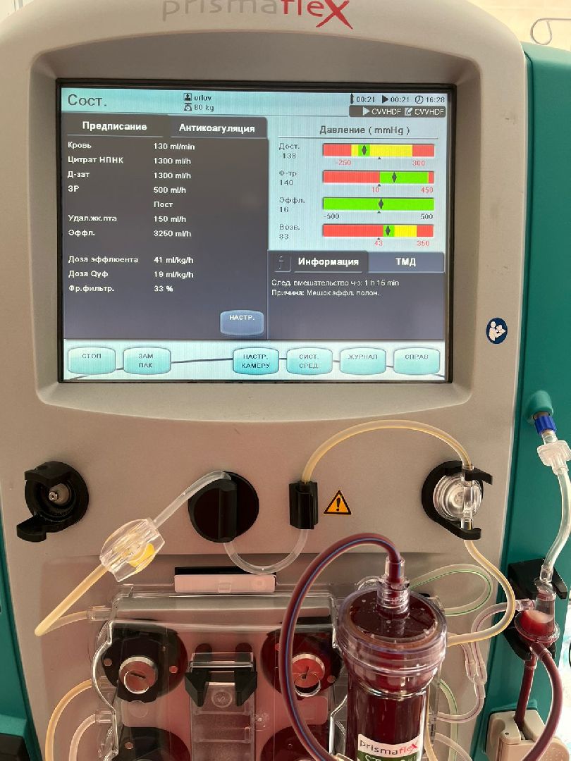 медицина, Воскресенская областная больница, гемодиализ, новое оборудование