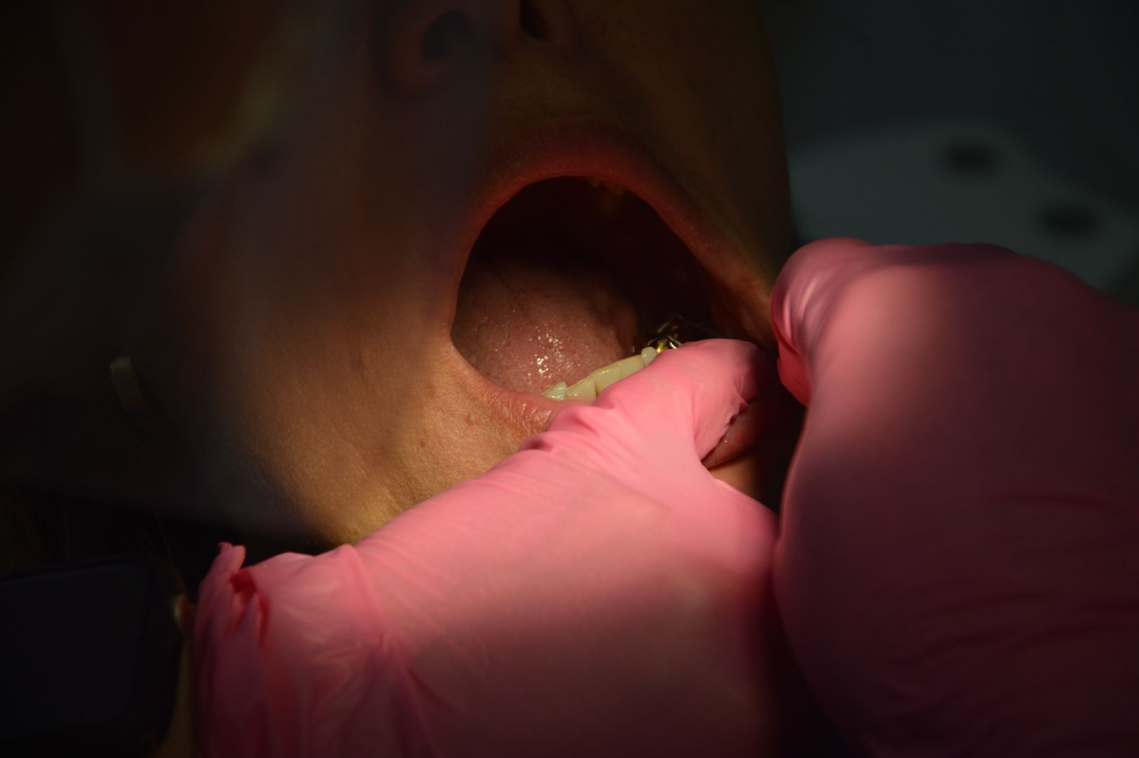 Шатура, стоматология, день медика,