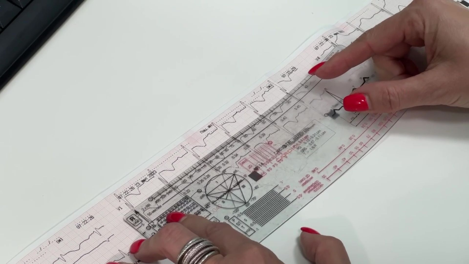 Реутов, здравоохранение, УЗИ, юбилей, врач