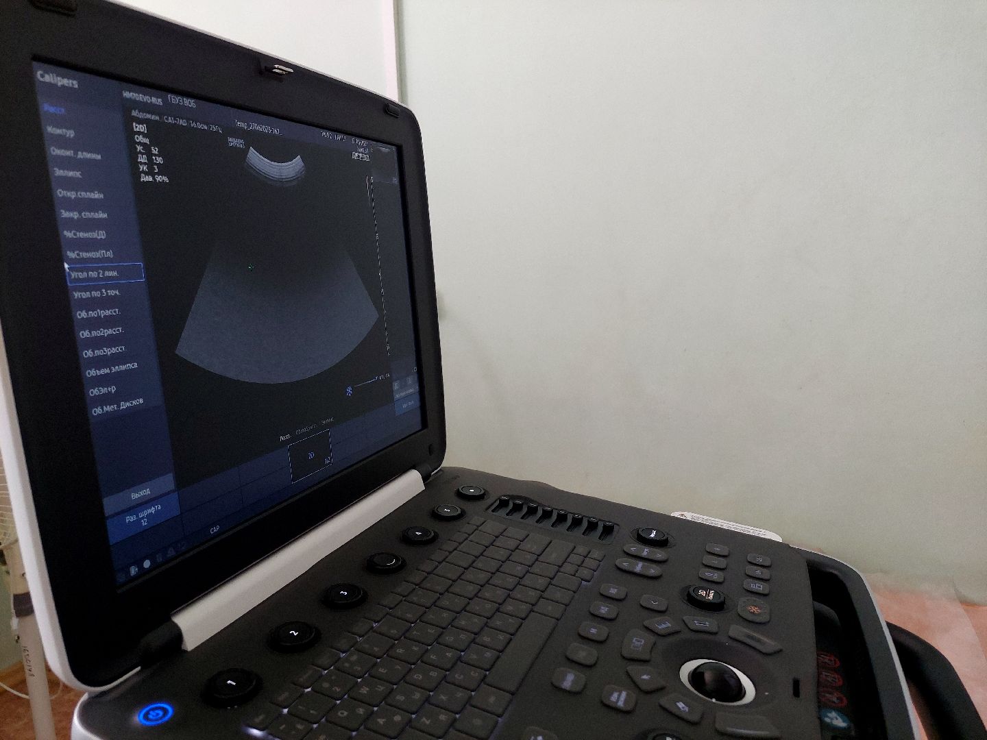 медицина, Воскресенская областная больница, УЗИ, новое оборудование