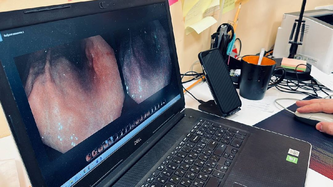 Одинцово, Онкология, Эндоскопическое оборудование, врач-онколог, диагностика раннего рака