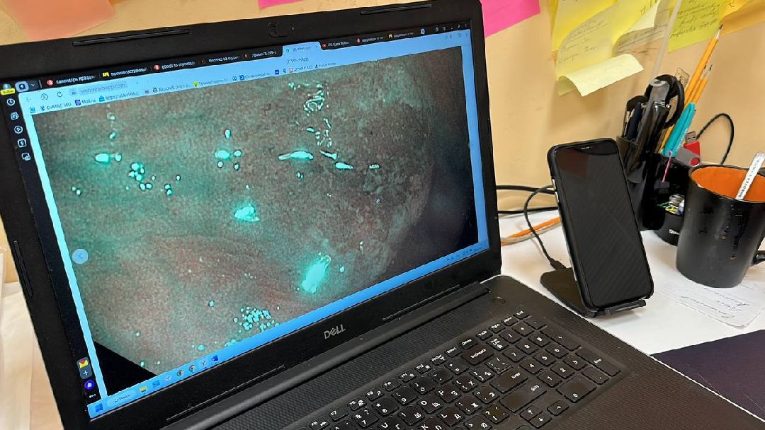 Одинцово, Онкология, Эндоскопическое оборудование, врач-онколог, диагностика раннего рака