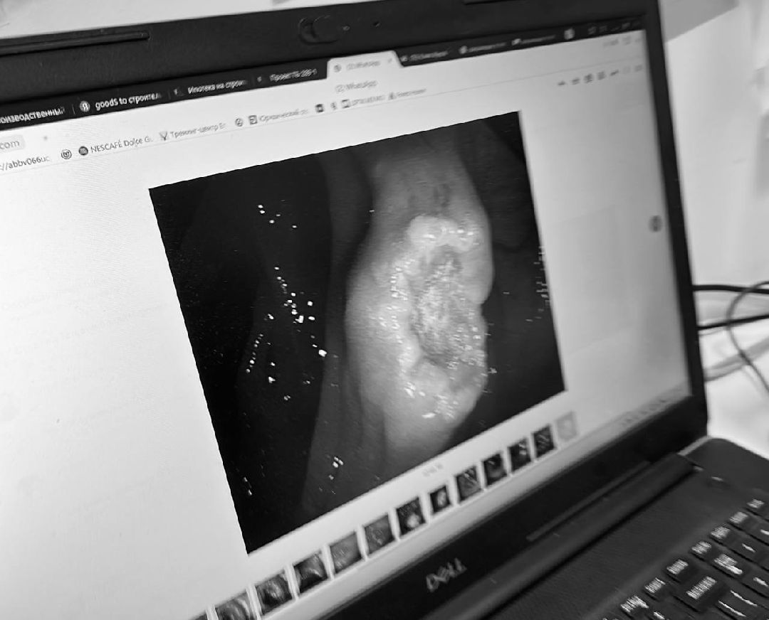 Одинцово, Онкология, Эндоскопическое оборудование, врач-онколог, диагностика раннего рака