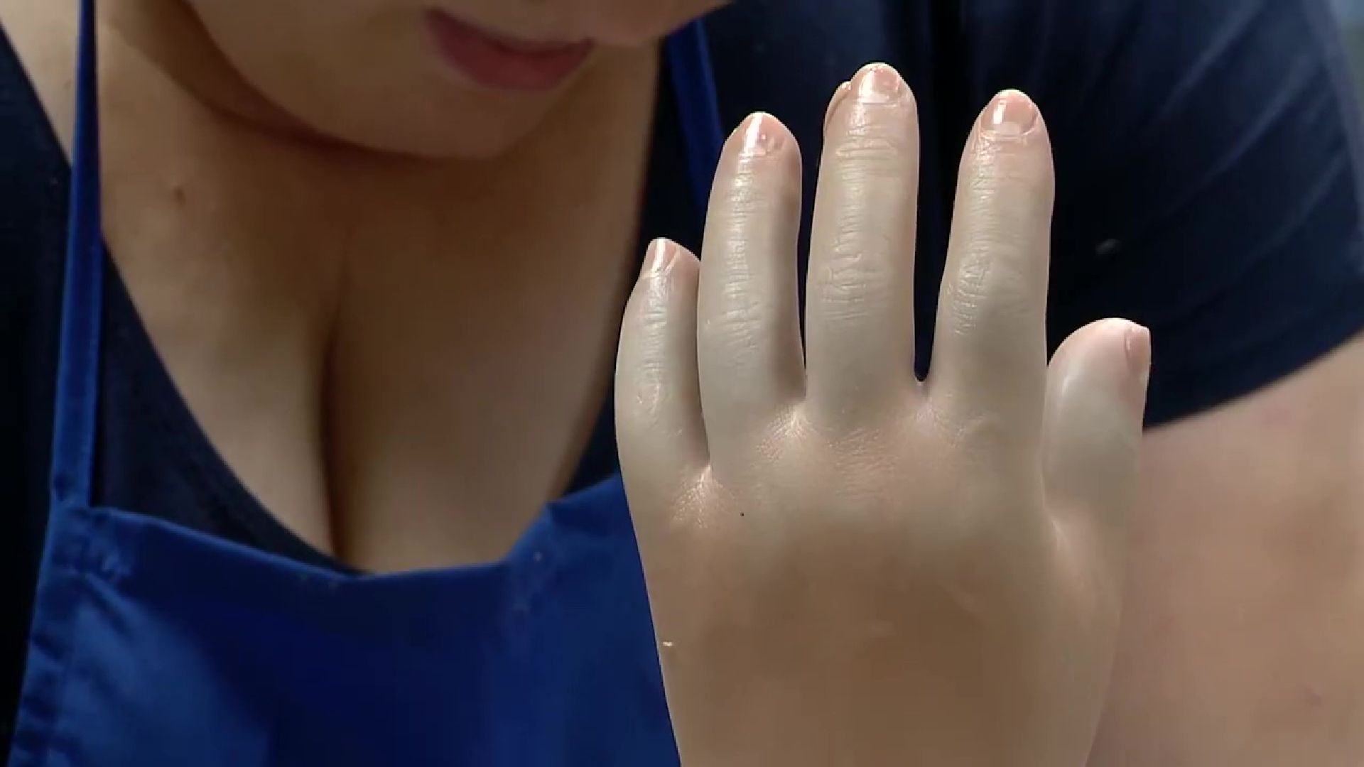 Реутов, СВО, протезы, кисть руки, стопа, коленный модуль, РЭЗСП