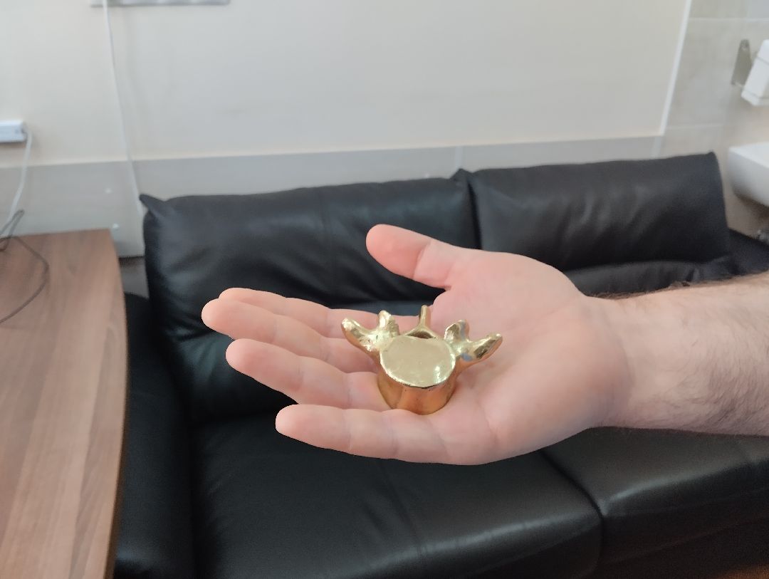 нейрохирурги, операция