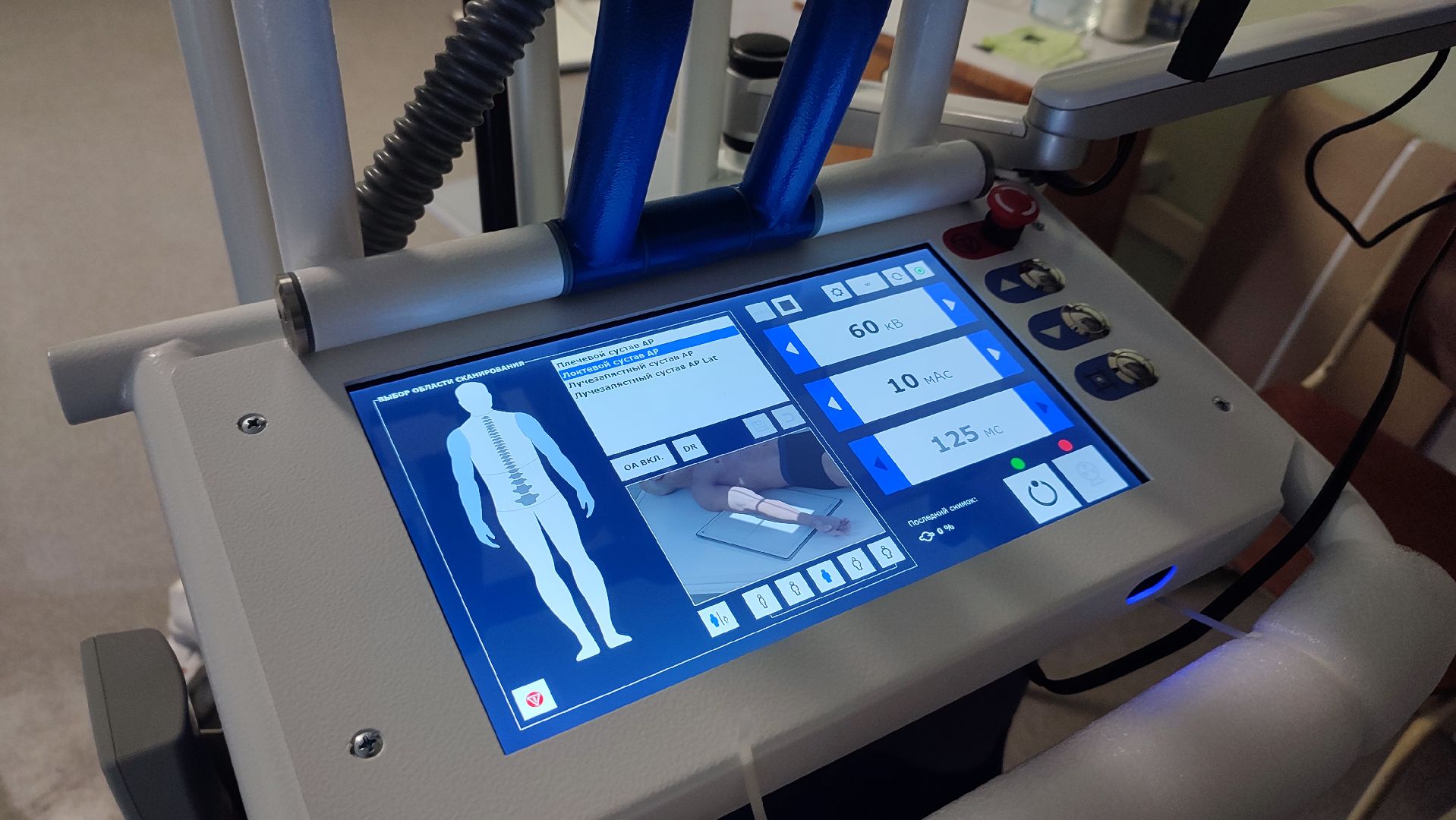 Кашира, медицина, рентген-аппарат, реанимация, хирургия, цифровизация