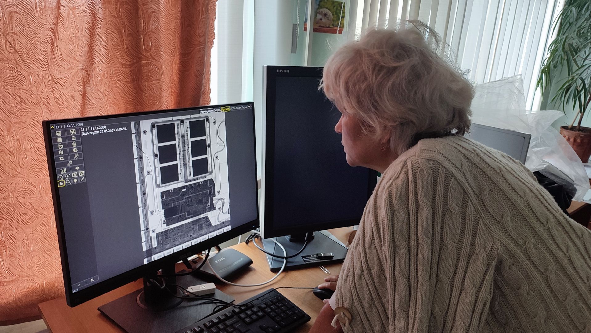 Кашира, медицина, рентген-аппарат, реанимация, хирургия, цифровизация