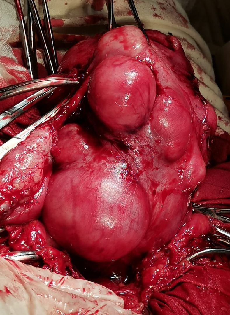 Солнечногорск, операция, врач, ребенок, мама