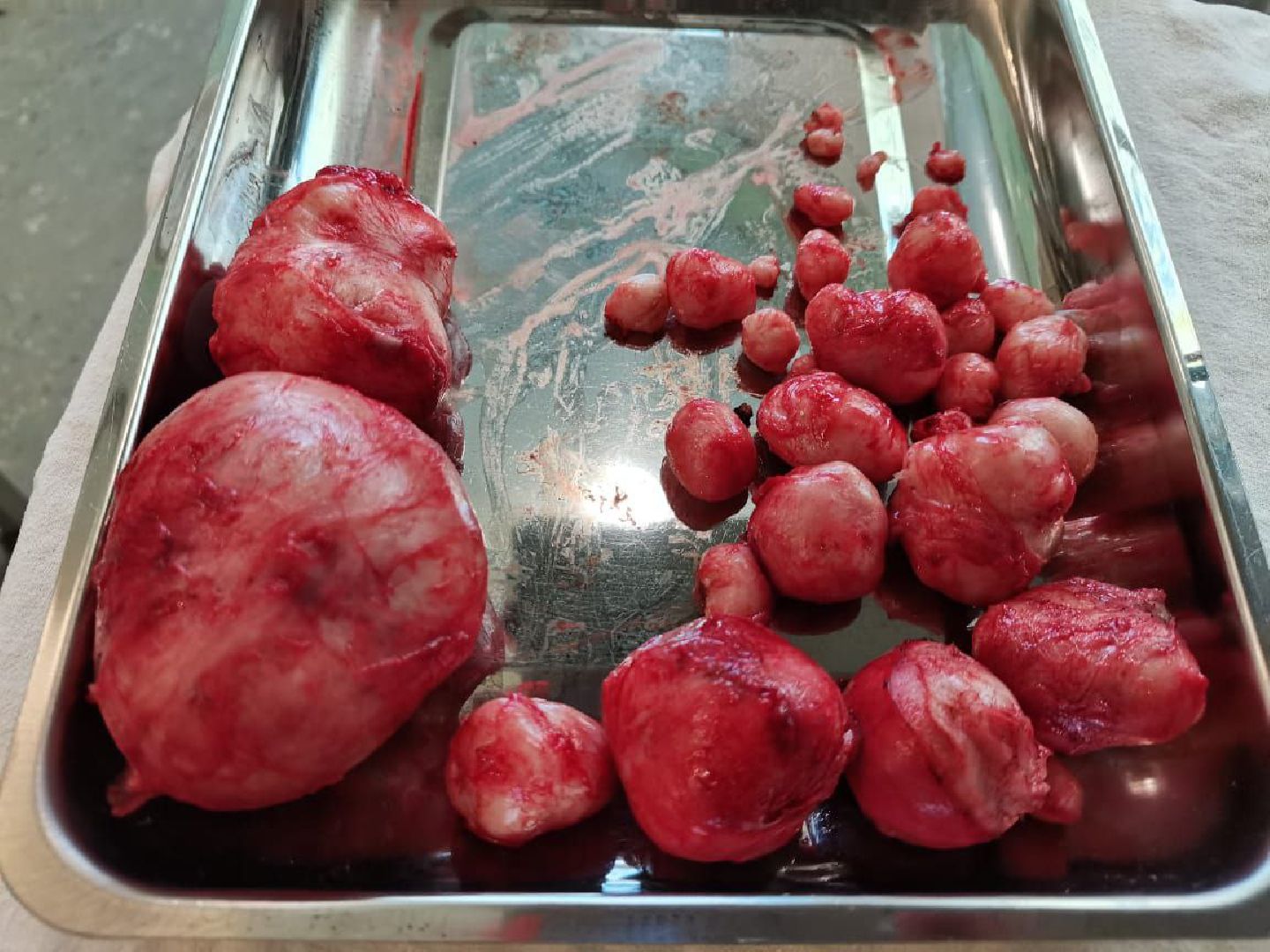 Солнечногорск, операция, врач, ребенок, мама