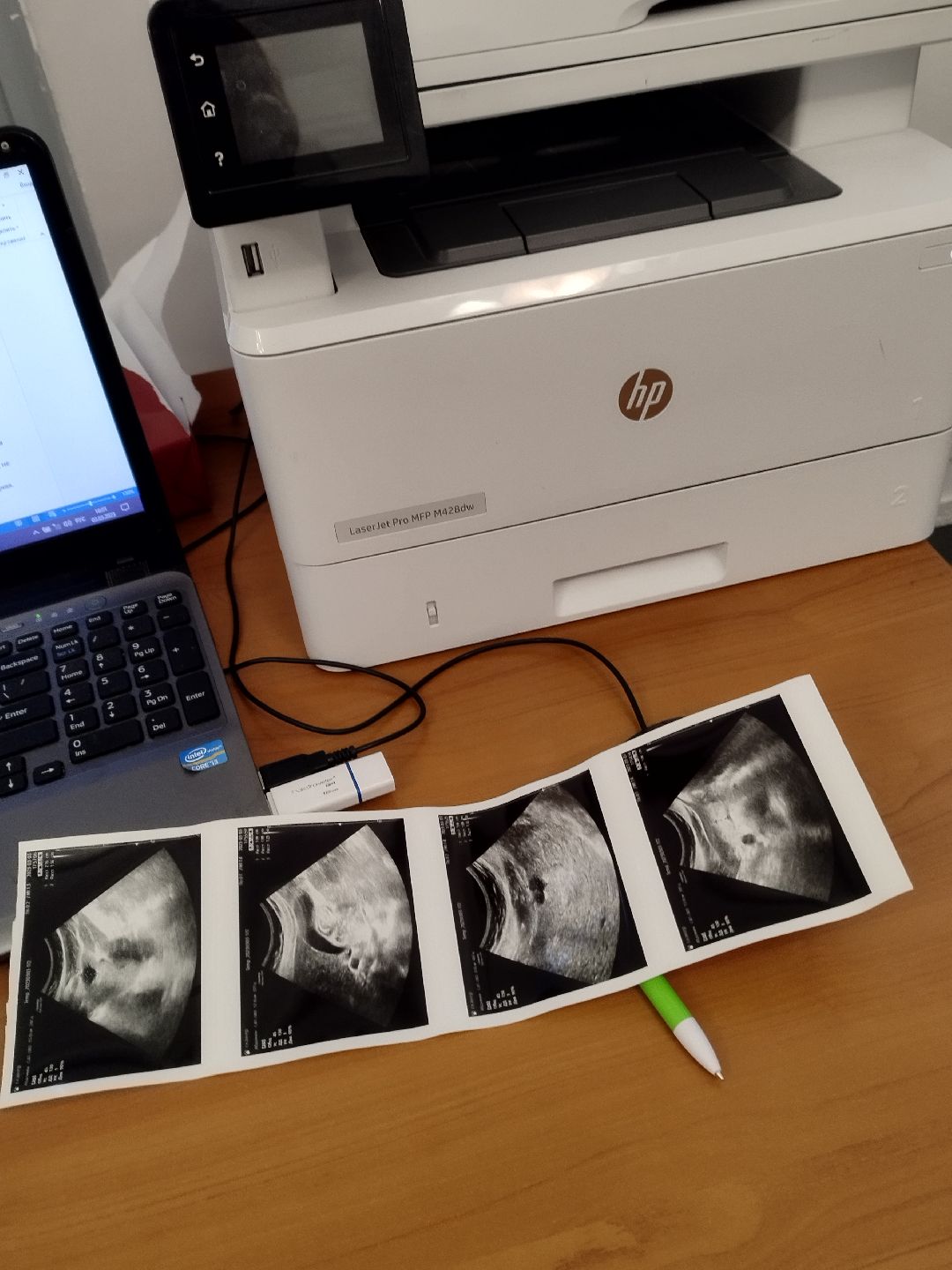 Истра, врачи, встреча с жителями, медицина, пенсионеры