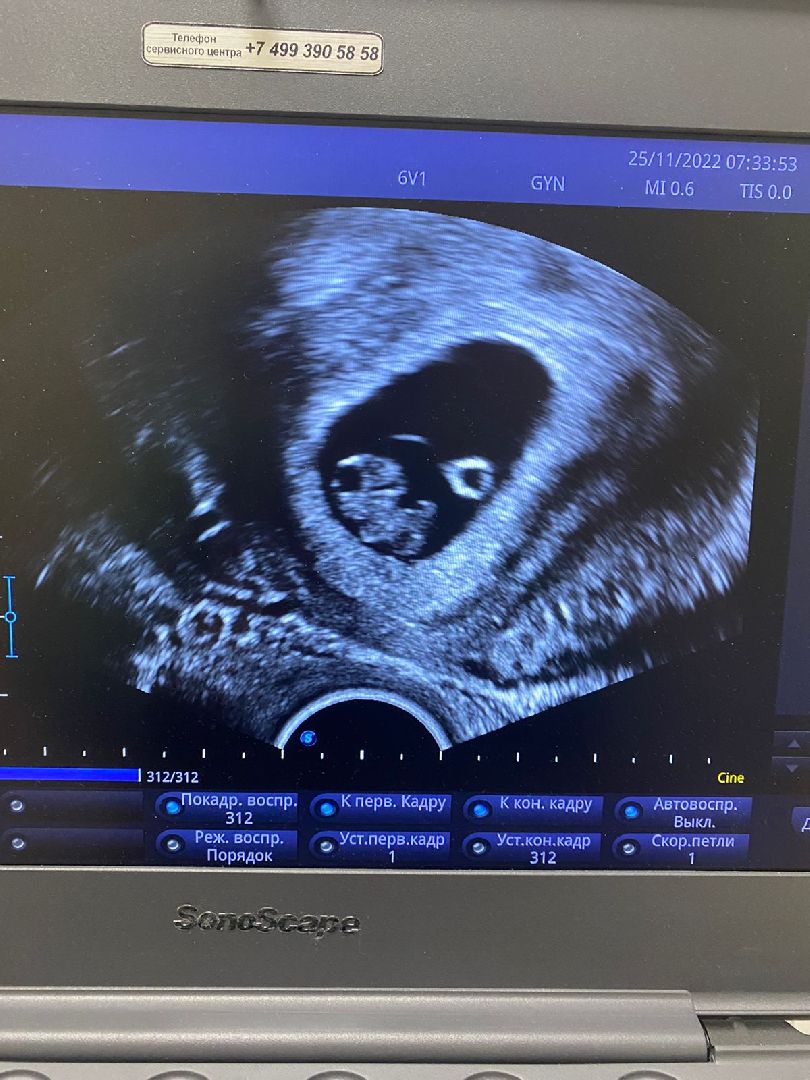 ЭКО в Подмосковье, стань мамой в Подмосковье, Наро-Фоминский перинатальный центр, Наро-Фоминск