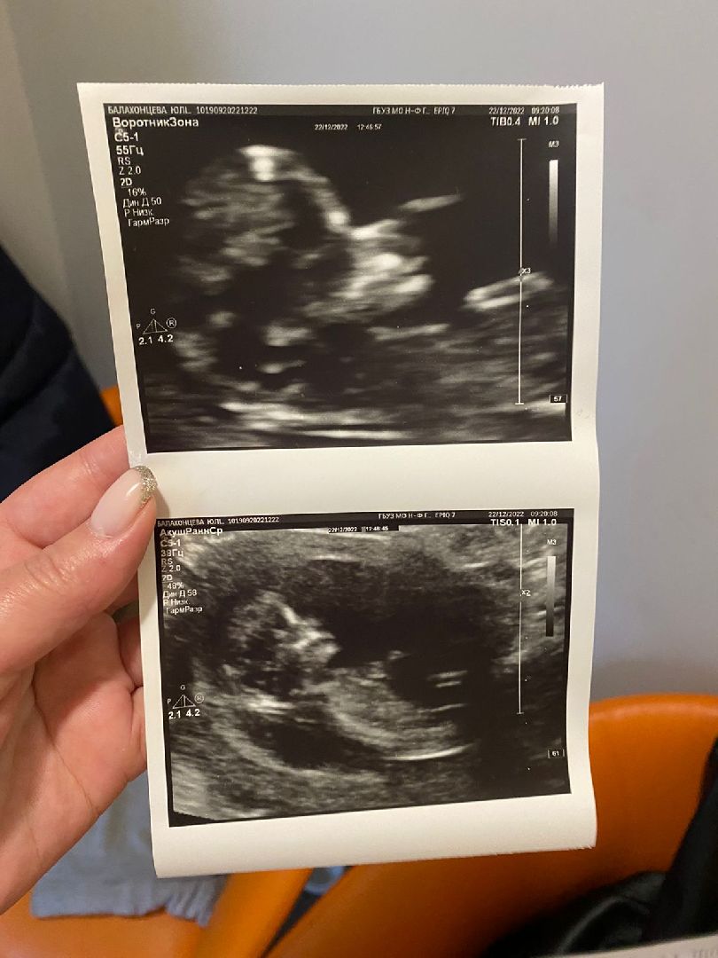 ЭКО в Подмосковье, стань мамой в Подмосковье, Наро-Фоминский перинатальный центр, Наро-Фоминск