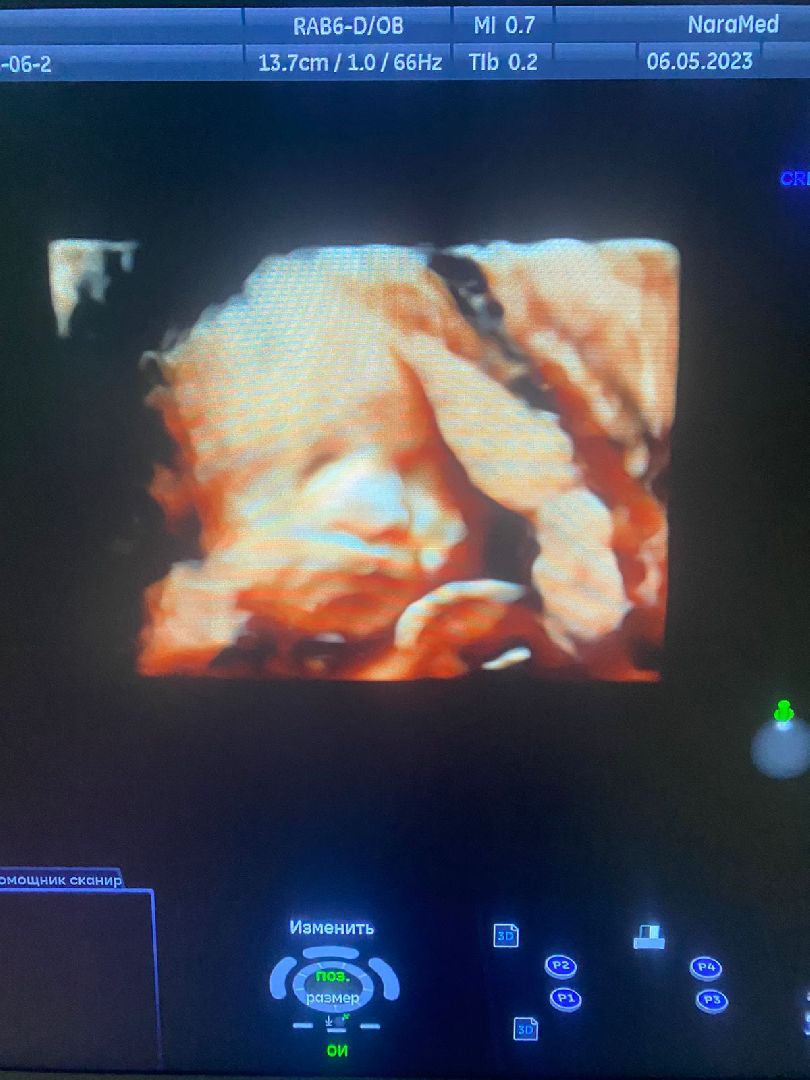 ЭКО в Подмосковье, стань мамой в Подмосковье, Наро-Фоминский перинатальный центр, Наро-Фоминск