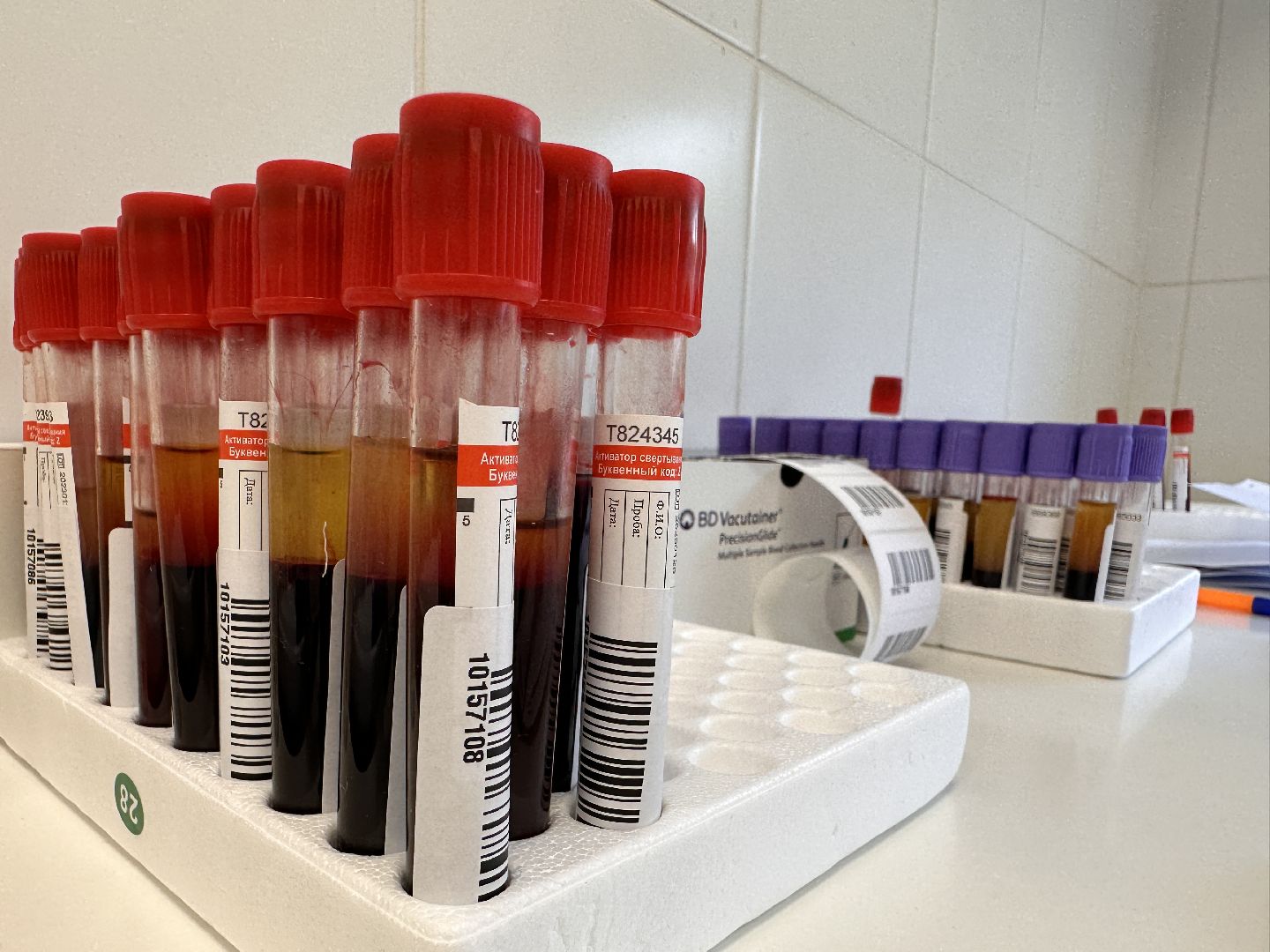 Одинцово, Здравоохранение, Иммунитет, Ковид