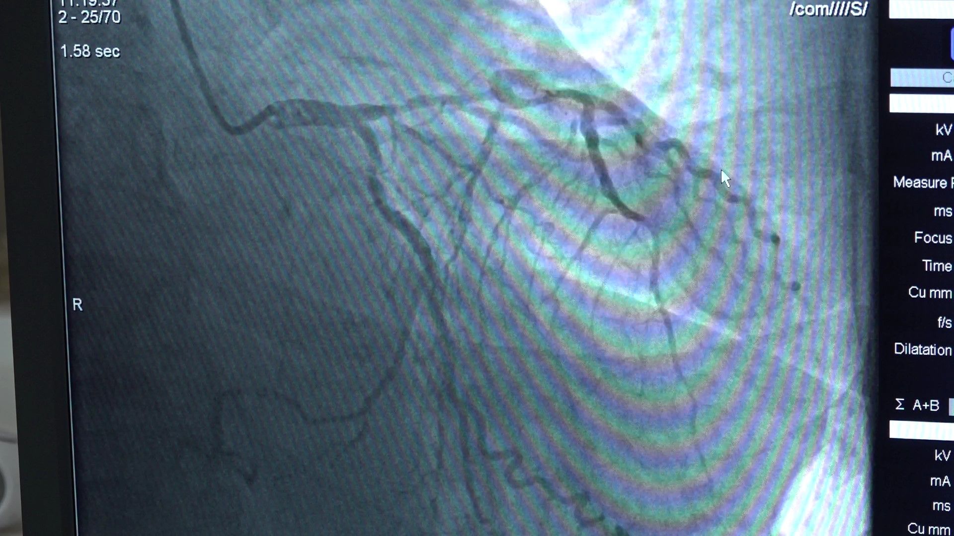 Сосудистый центр, Домодедово