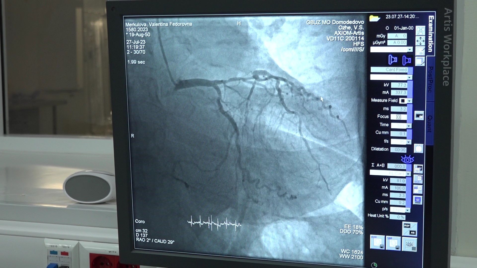 Сосудистый центр, Домодедово