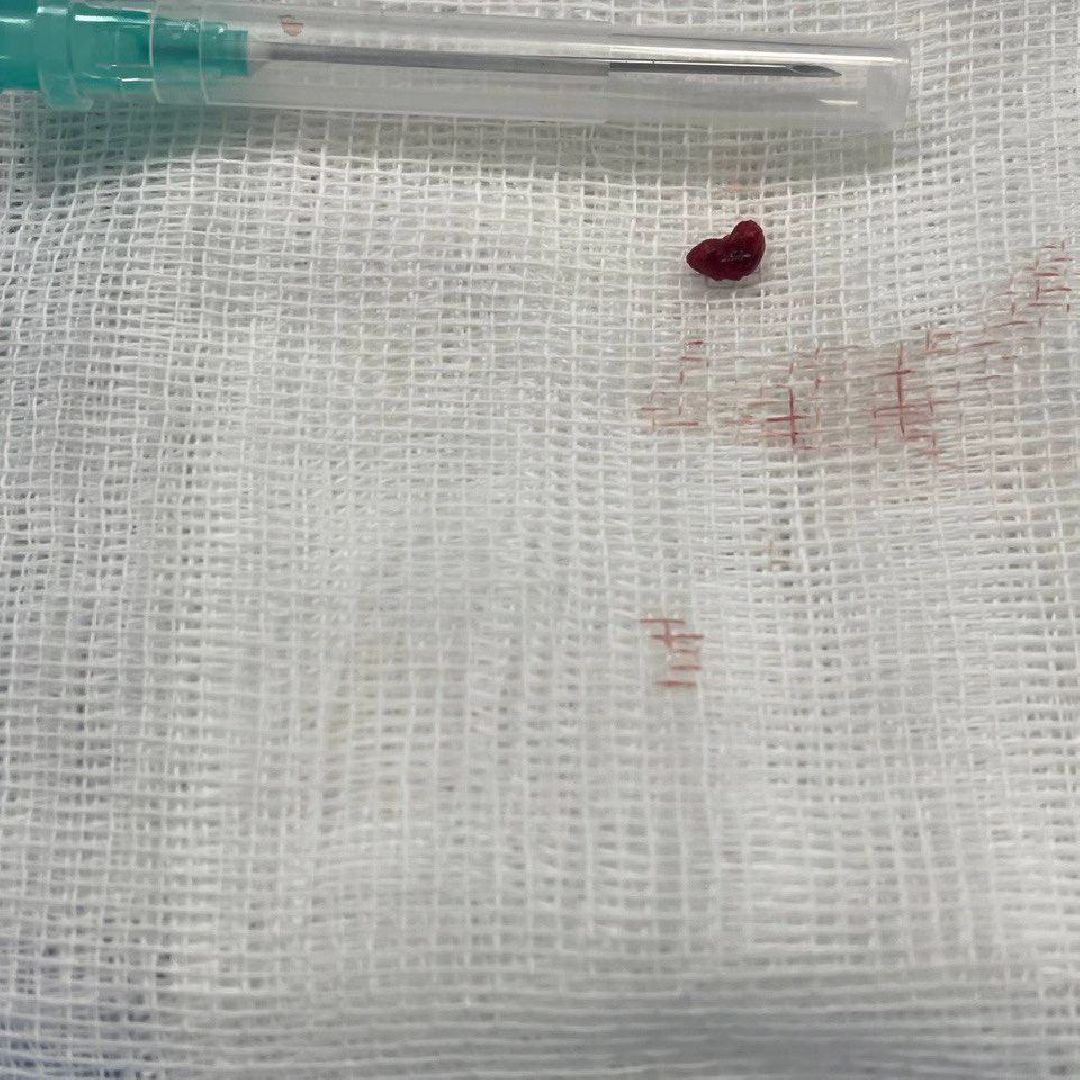 Лапино, Инсульт, Одинцово, Здравоохранение