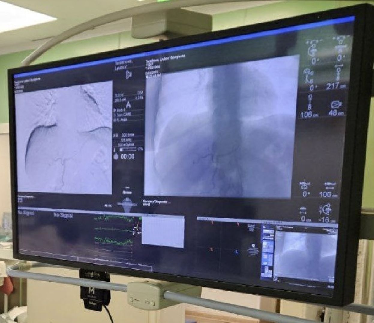 Балашиха, Подмосковье, медицина, МООД, рак, рентгенохирургия,