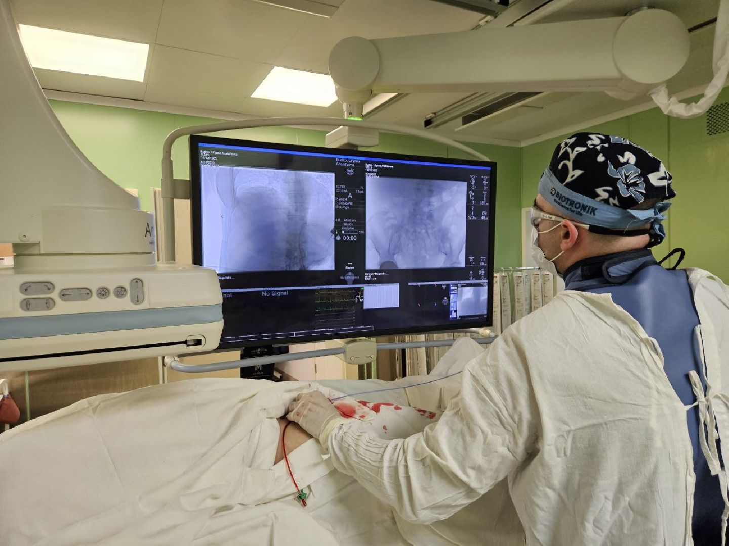 Балашиха, Подмосковье, медицина, МООД, рак, рентгенохирургия,