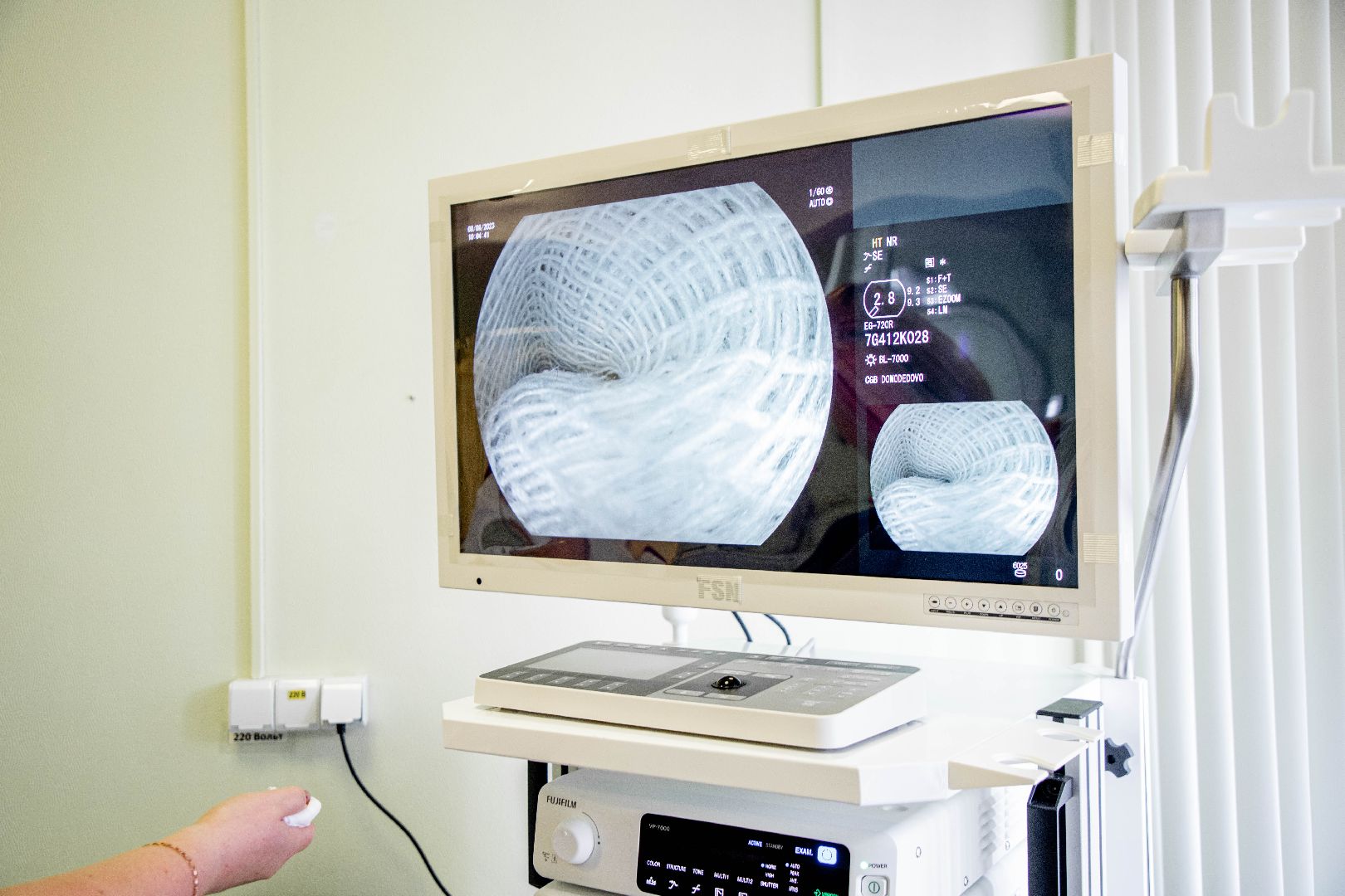 эндоскопическое оборудование, Домодедовская больница