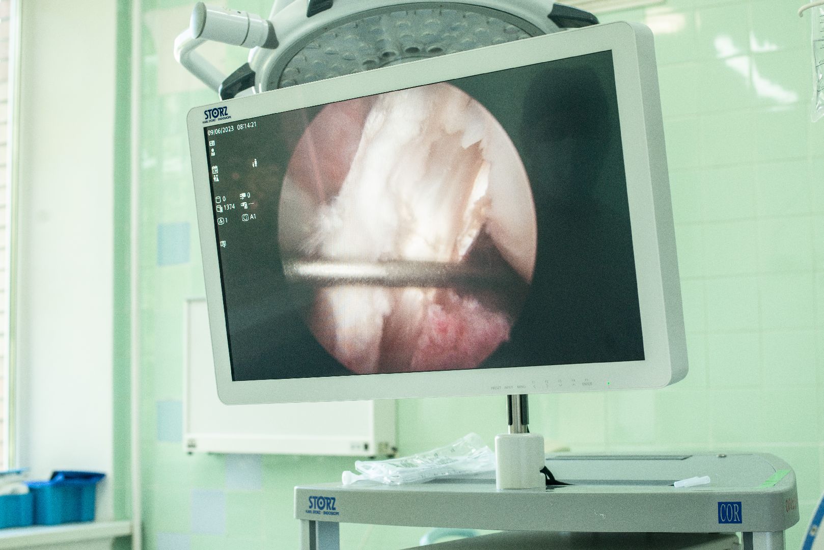 Солнечногорск, медицина, травматология, операции, оборудование