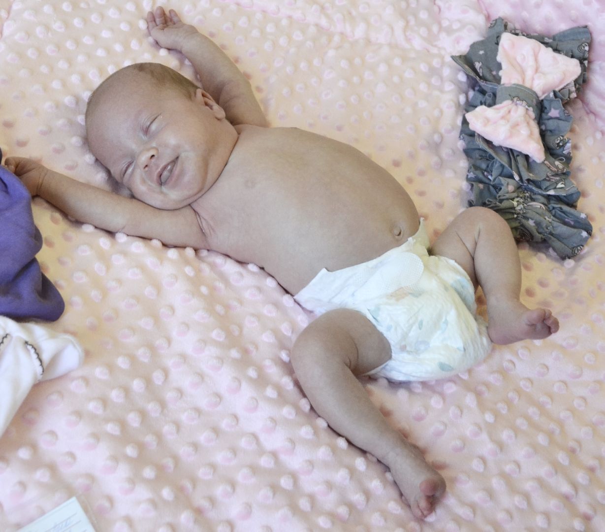 Балашиха, Подмосковье, медицина, МОПЦ, тройня