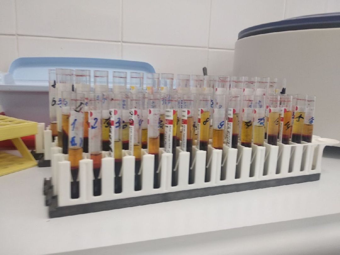 Дмитров, Дмитровская областная больница, клинико-диагностическая лаборатория