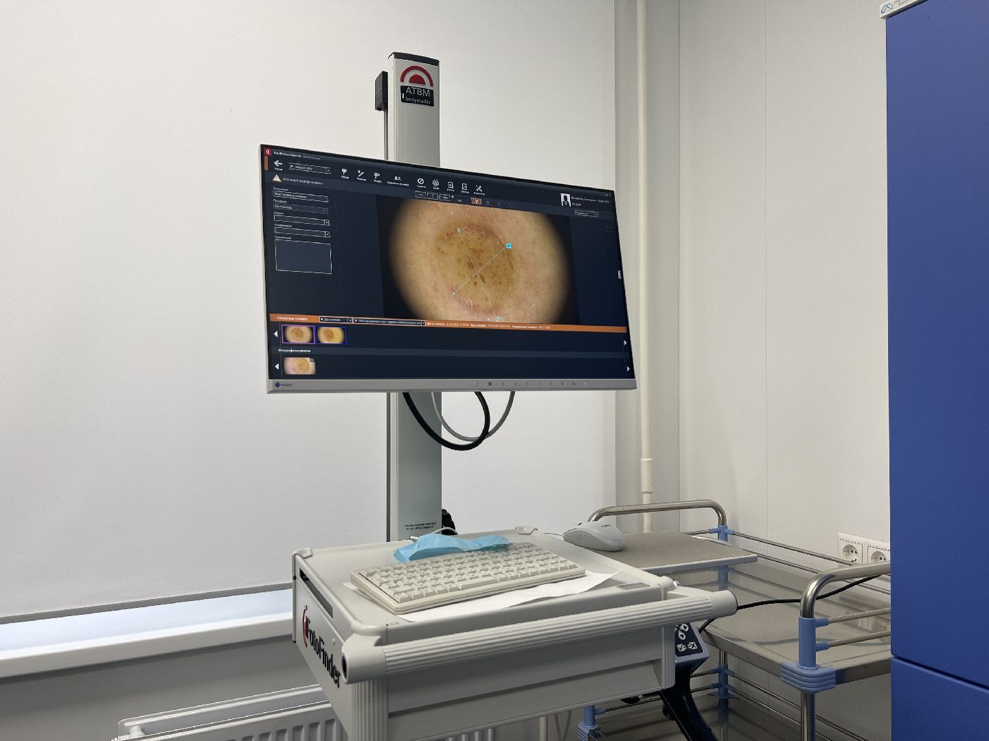 Химки, медицина, день здоровой кожи