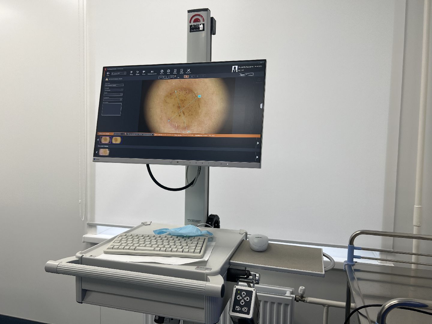 Химки, медицина, день здоровой кожи