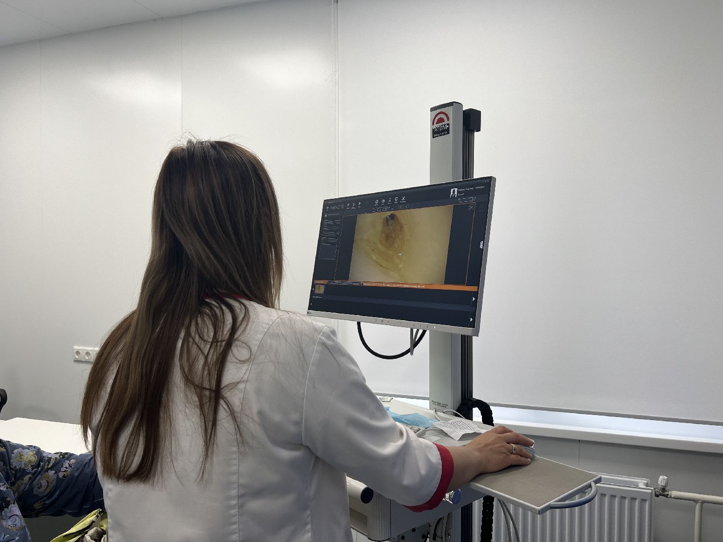 Химки, медицина, день здоровой кожи