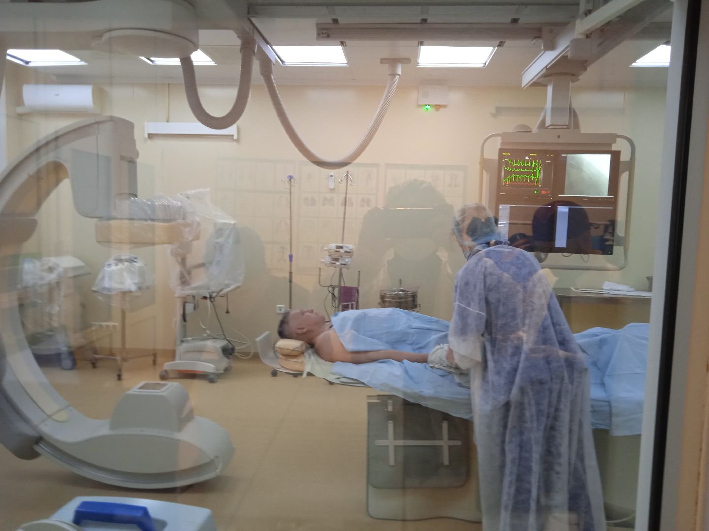 инсульт, юная, пациентка, ОКБ, Гегенава, Семёнов, Мартынович, Александра, операция, фенестарция, аневризма