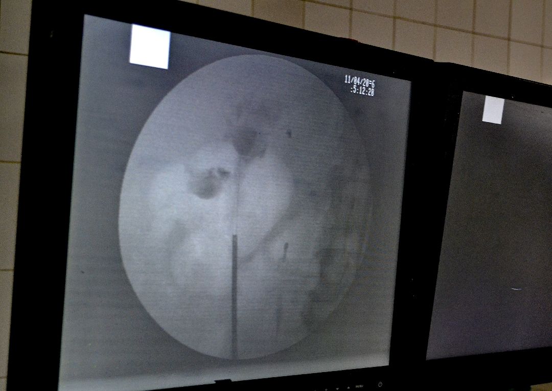 Балашиха, медицина, урология, медицинские учреждения, здоровье, здравоохранение