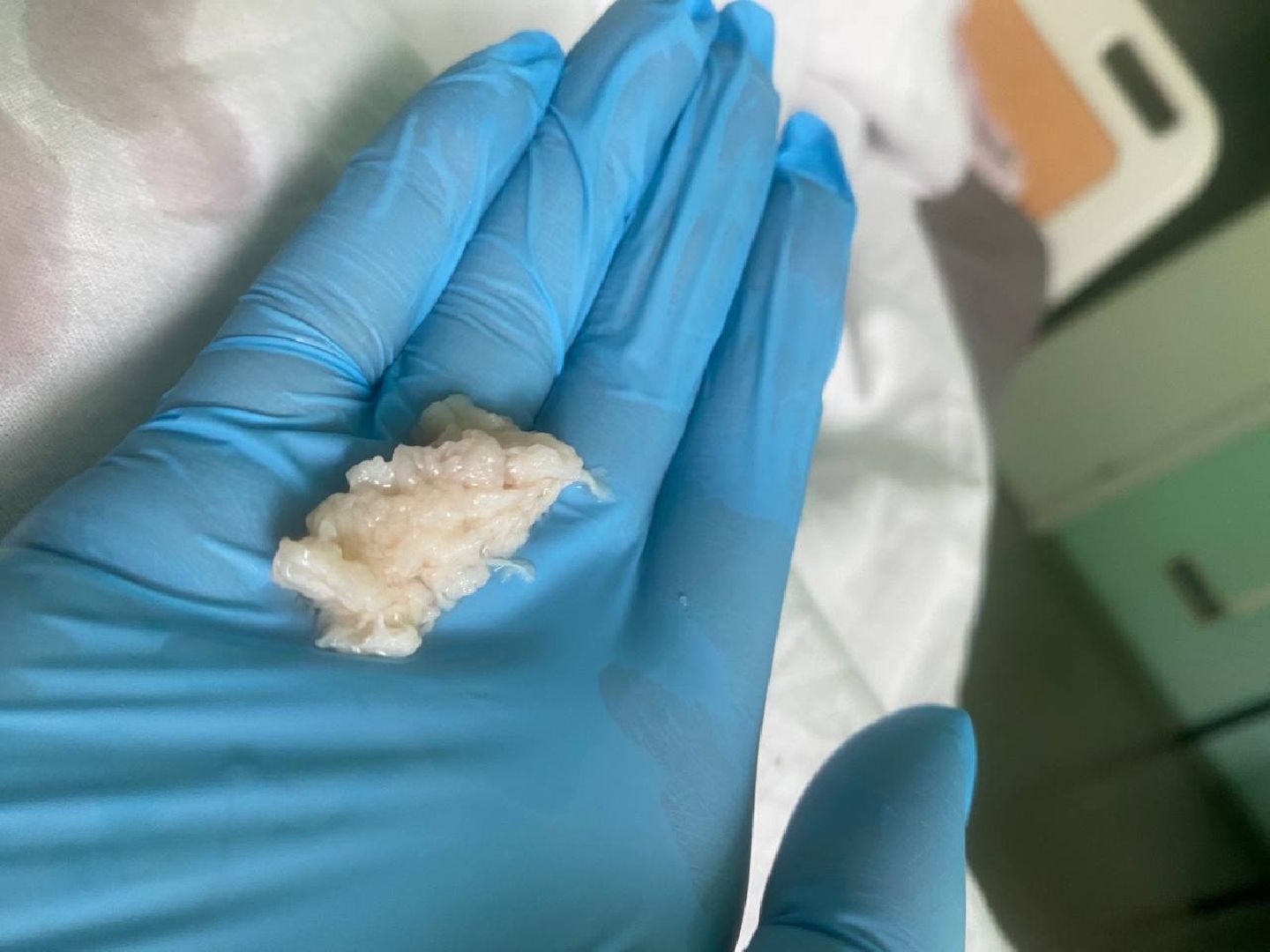 Реутов, Медицина, здравоохранение, врачи, операции, нейрогирургия,