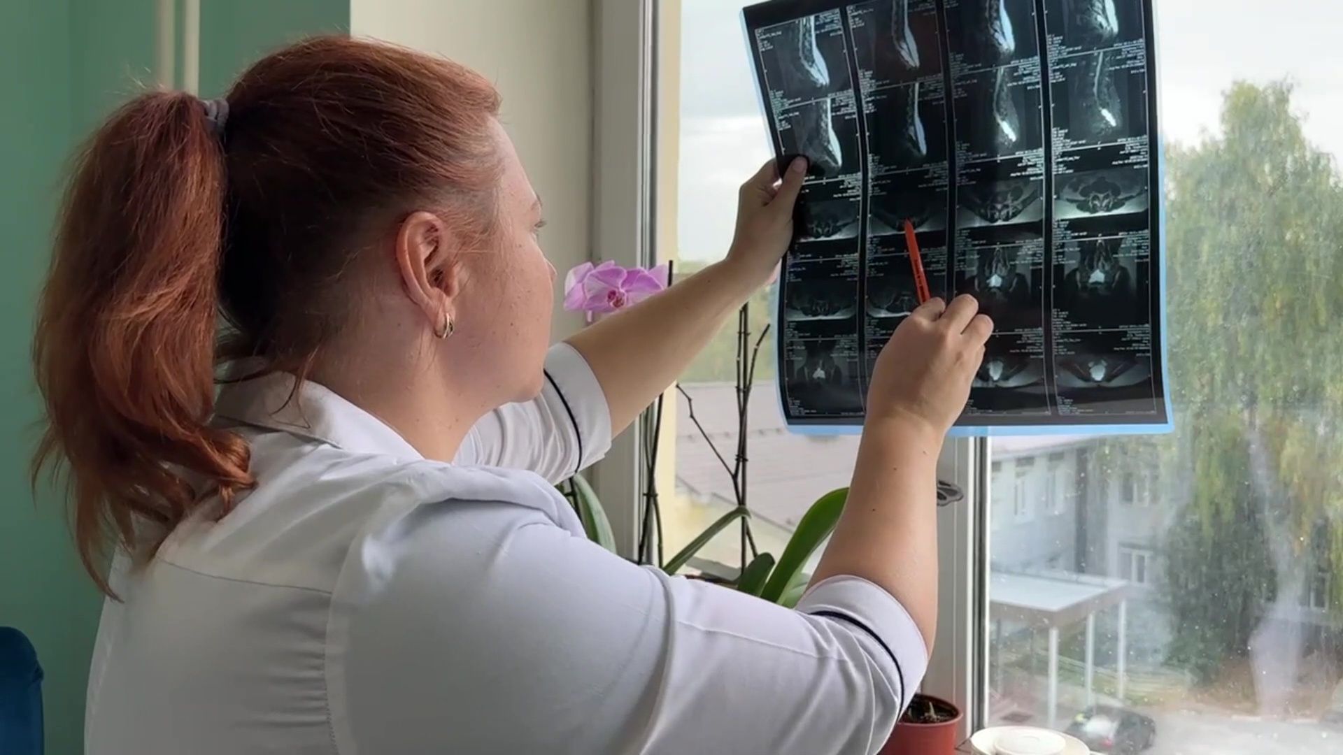 Реутов, Медицина, здравоохранение, врачи, операции, нейрогирургия,