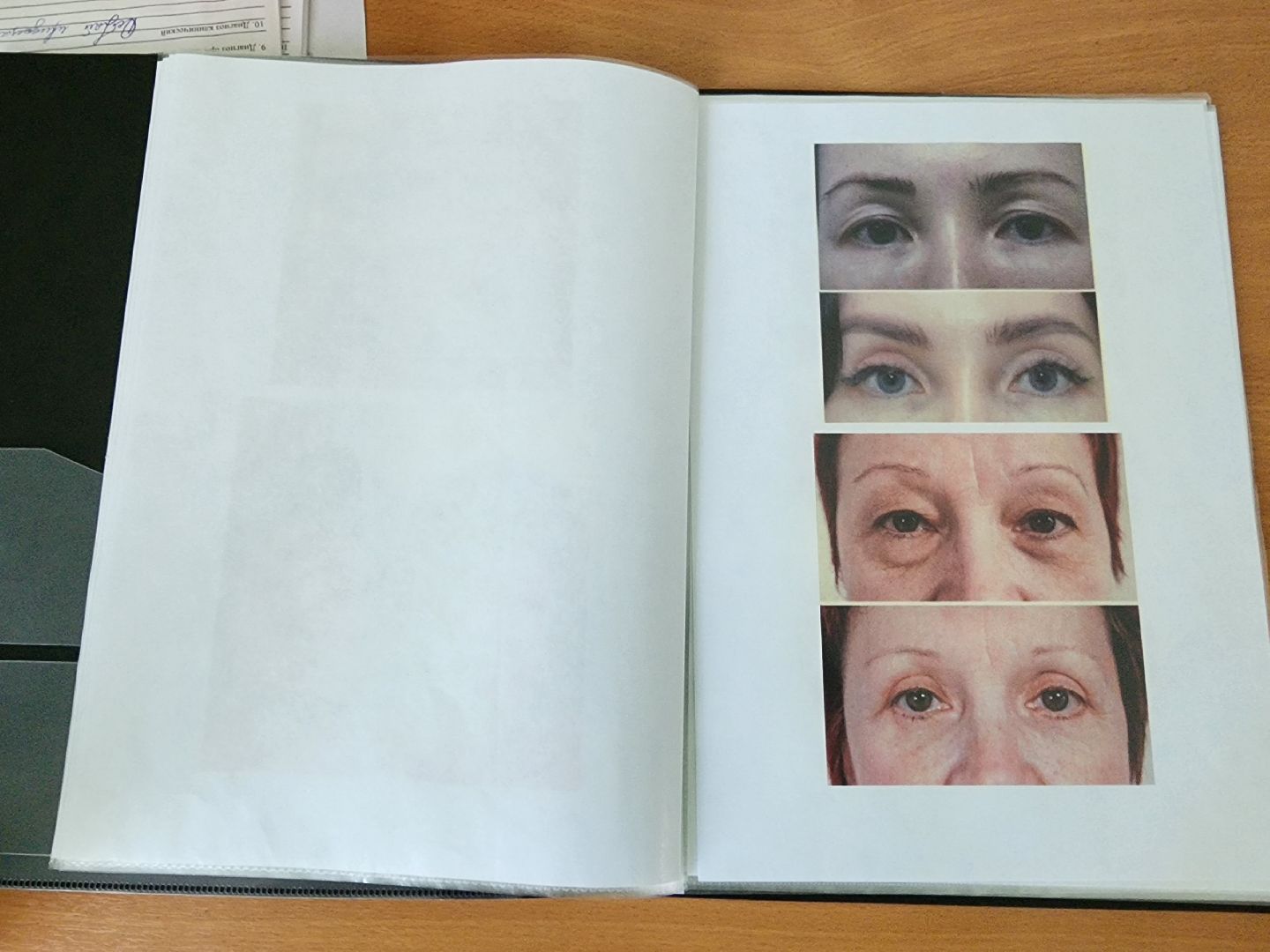 дедовск, истра, зрение,