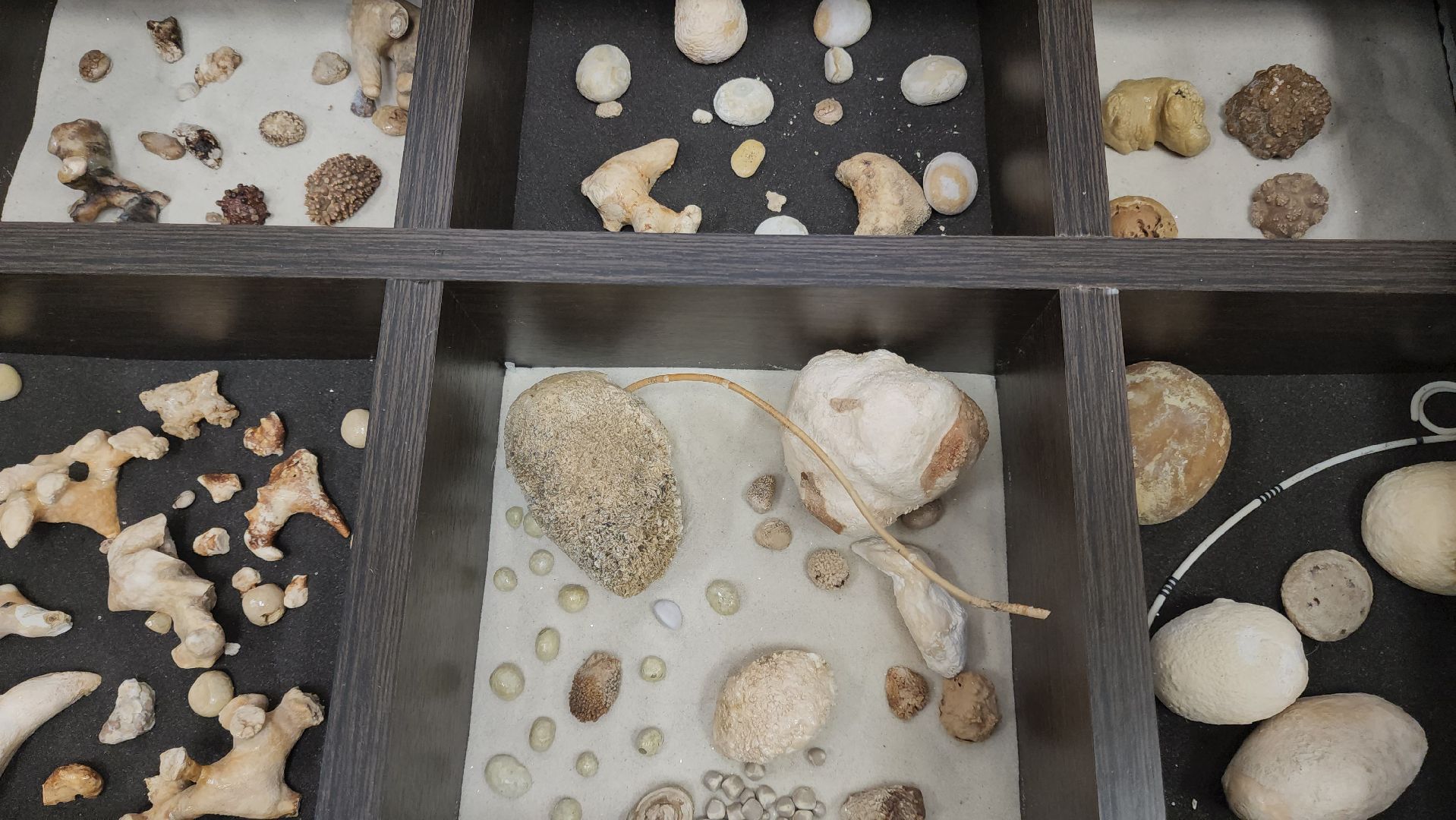 Подольск, Урология, Медицина, Здоровье, Камни в почках,