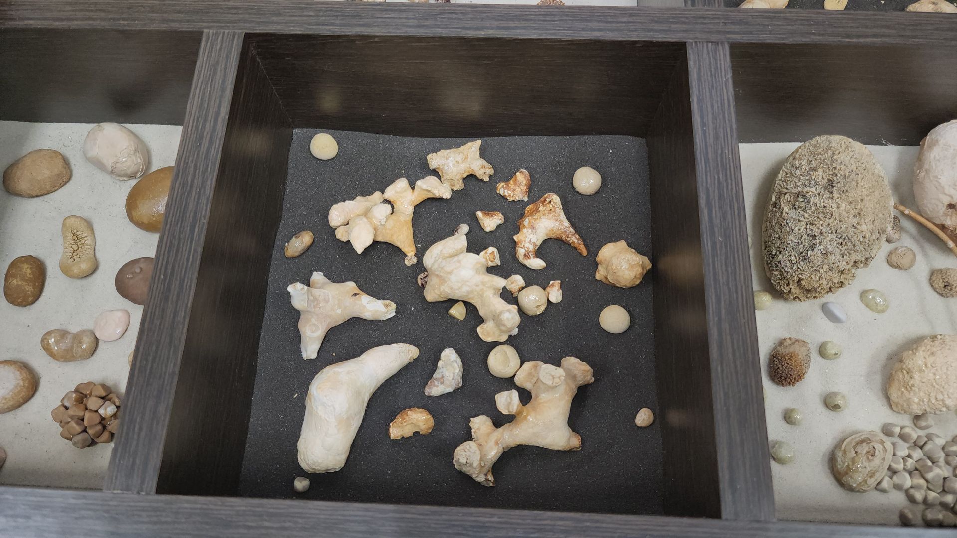 Подольск, Урология, Медицина, Здоровье, Камни в почках,