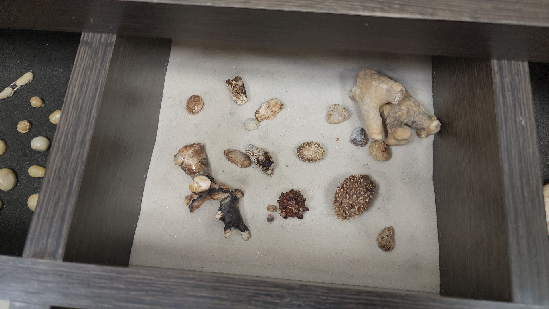 Подольск, Урология, Медицина, Здоровье, Камни в почках,