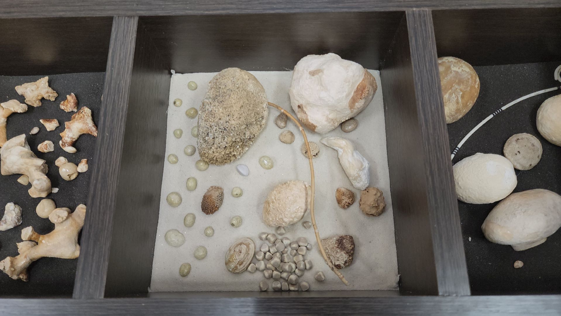 Подольск, Урология, Медицина, Здоровье, Камни в почках,