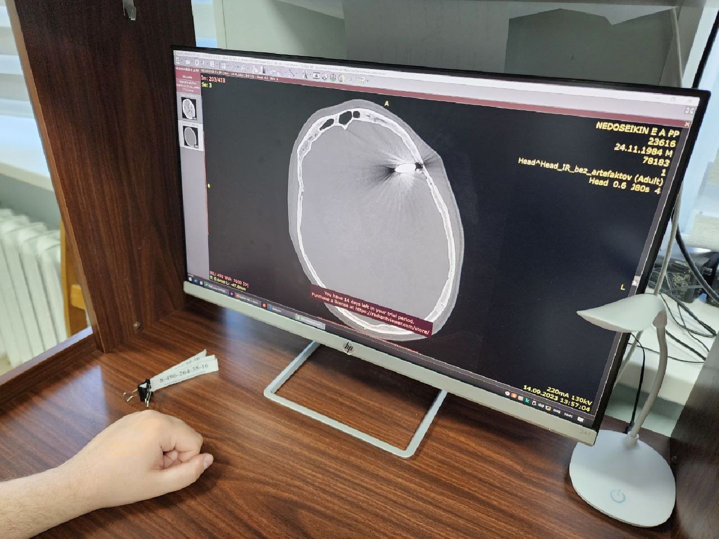 Солнечногорск, Медицина, Врач, Операция, Пациент,