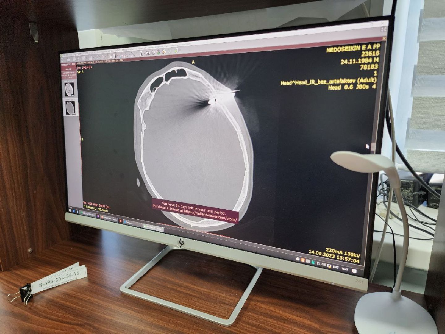 Солнечногорск, Медицина, Врач, Операция, Пациент,