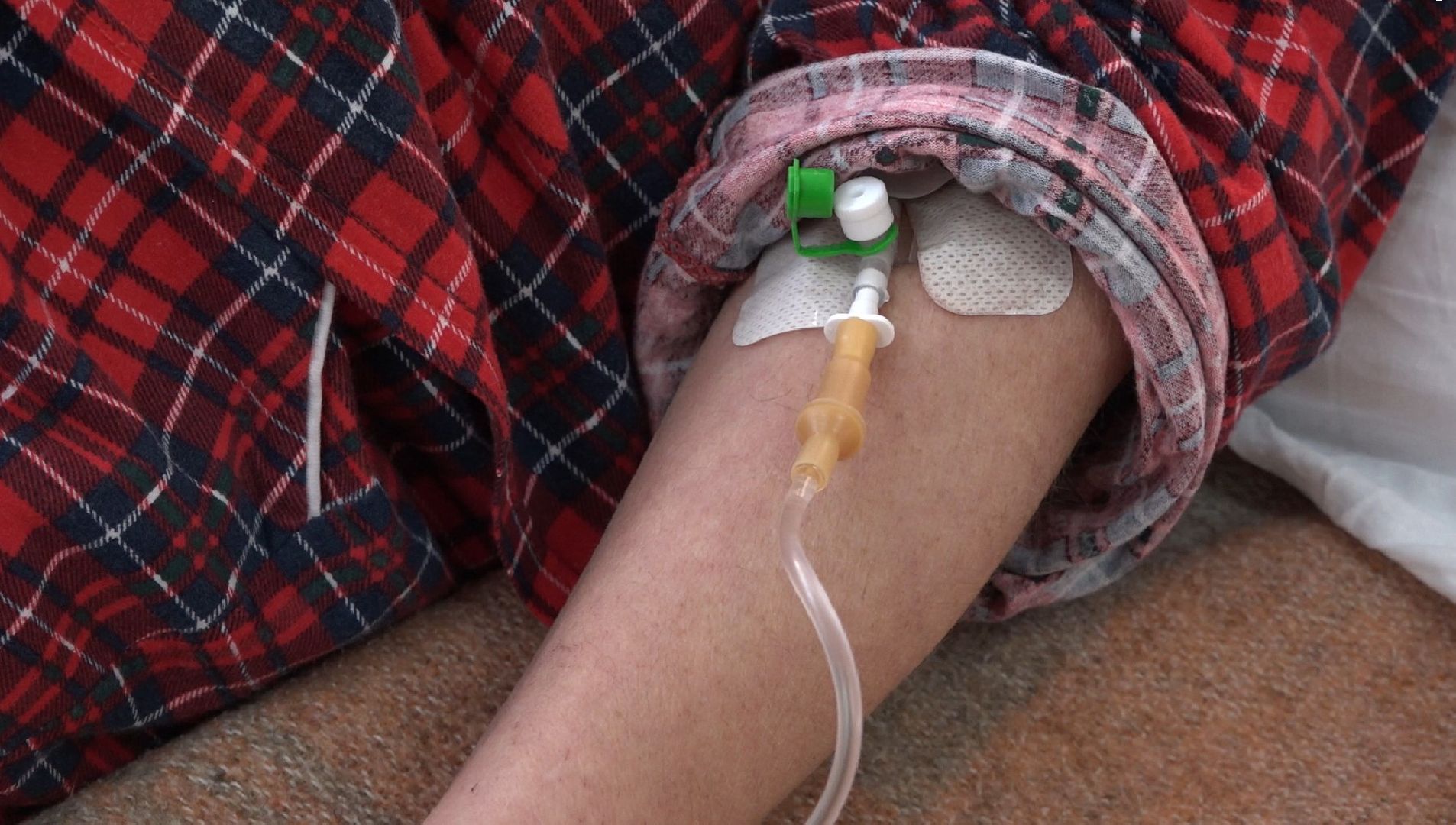 киста-чудовище, Домодедовская больница,