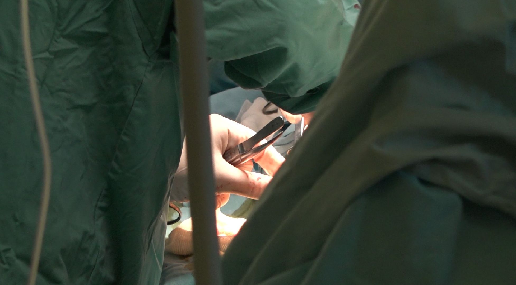 киста-чудовище, Домодедовская больница,