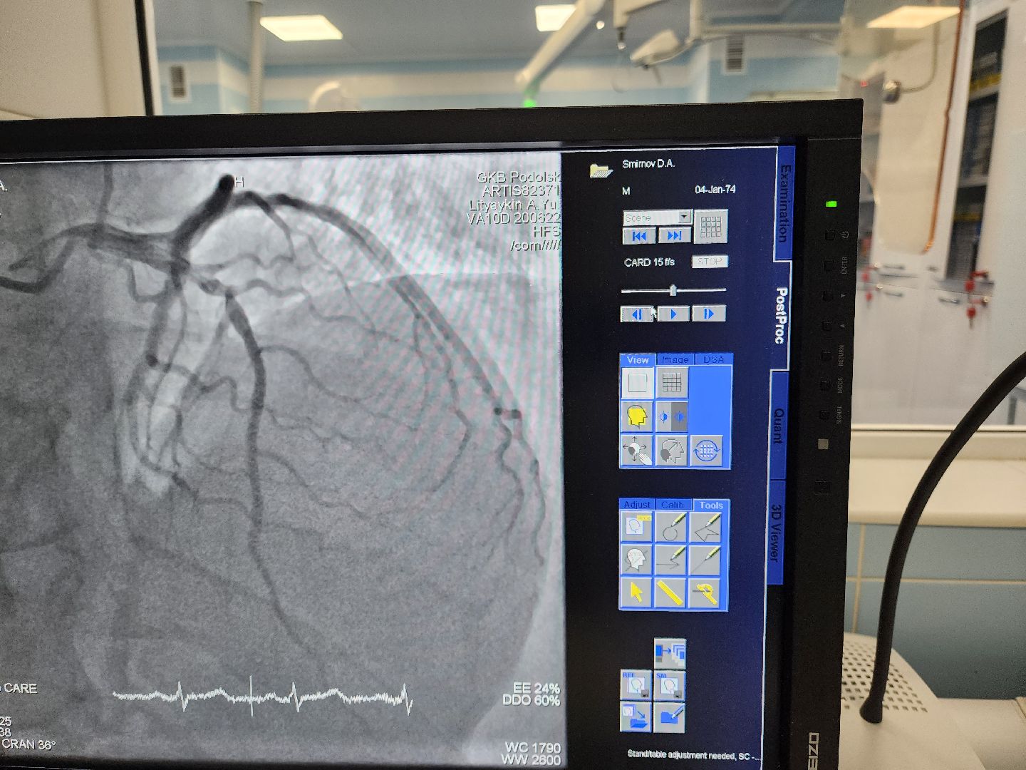 Подольск, Медицина, День сердца, Кардиолог, Здоровье,