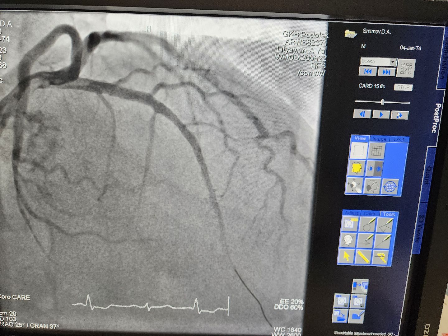 Подольск, Медицина, День сердца, Кардиолог, Здоровье,